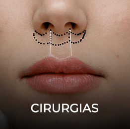 Lip-Lift-cirurgias-imagem.png